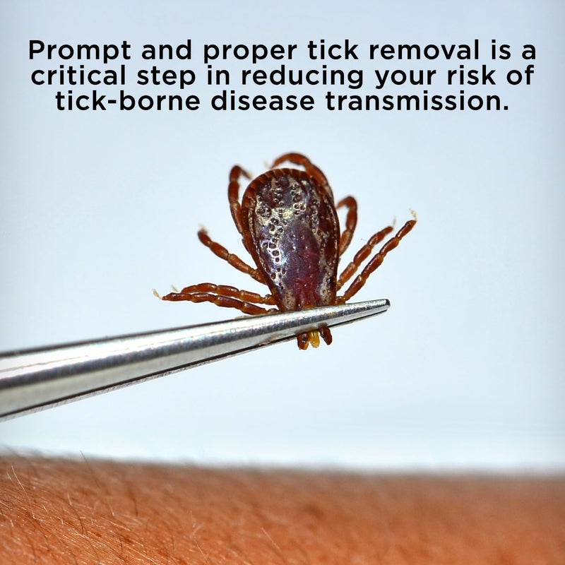 BUG BITE THING Tick Remover Tool for People & Pets, Patented Two Sided Stainless Steel Design with Fine Tipped Tweezers, Formerly Known as TickEase - Image 5