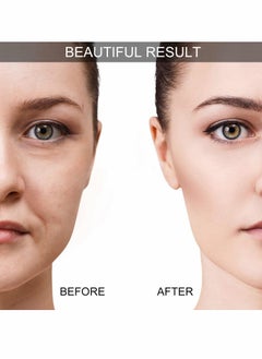 كاست ويف طقم علاج حجامة للوجه من السيليكون مجموعة أكواب تدليك للعين والوجه بأربعة أكواب مع فرشاة تنظيف وتقشير مجانية مضادة للتجاعيد ومضادة للشيخوخة باللون الوردي  - Image 4