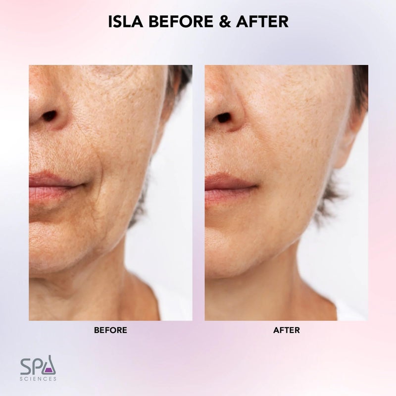 Spa Sciences ISLA Ice + Heat Contouring Roller (Face, Neck, and DÃ©colletage) â€“ Including Steel + Bonus Genuine Rose Quartz Globes - Image 3