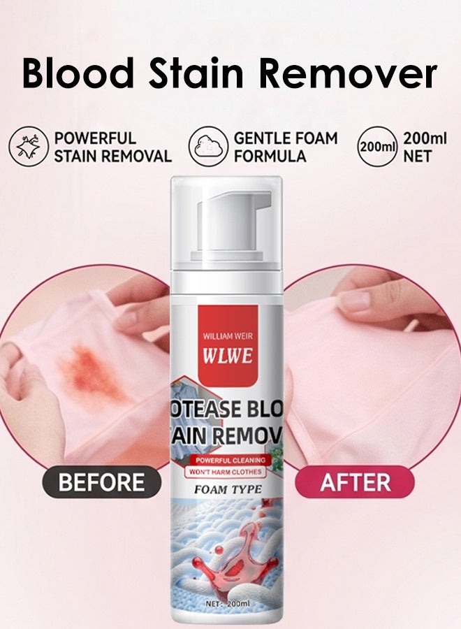 WILLIAM WEIR 200ml Blood Stain Remover Foam Cleaner for Clothes Mattress Sheets Underwear Laundry Powerful Cleaning - Image 1