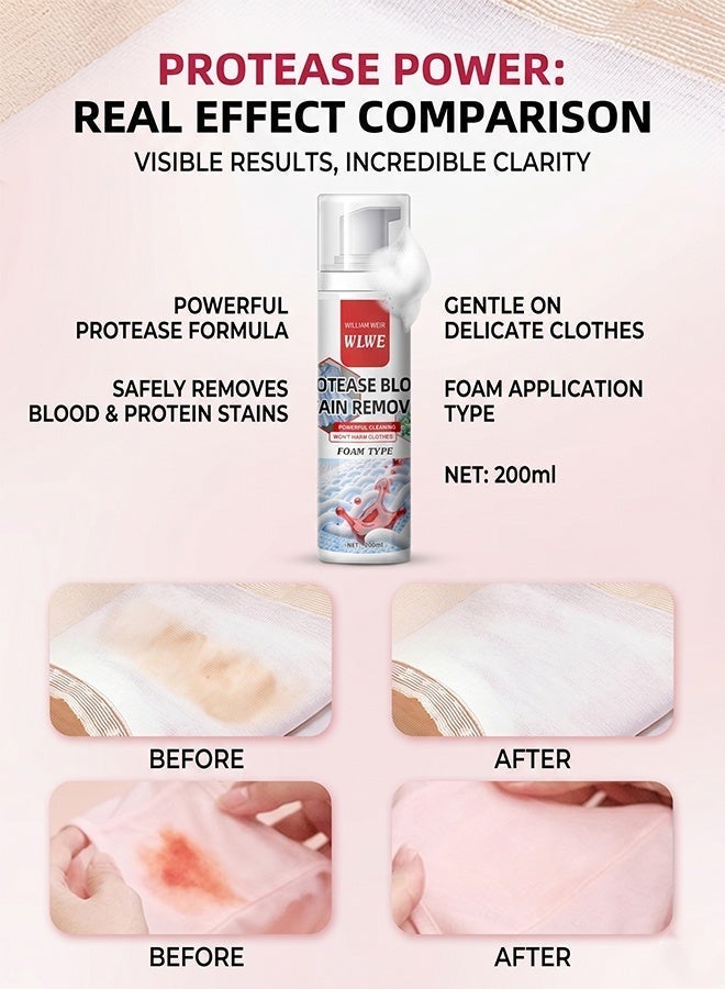 WILLIAM WEIR 200ml Blood Stain Remover Foam Cleaner for Clothes Mattress Sheets Underwear Laundry Powerful Cleaning - Image 4