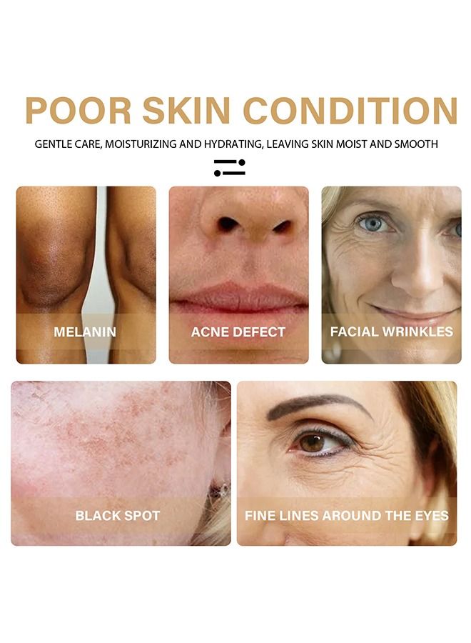 EELHOE Turmeric Oil, Dark Spot And Anti-Aging Turmeric Repair Face Serum, Natural Turmeric Bright Skin Dark Spot Skin Care Moisturizing Repair Serum Turmeric Oil For Face 30ml - Image 5