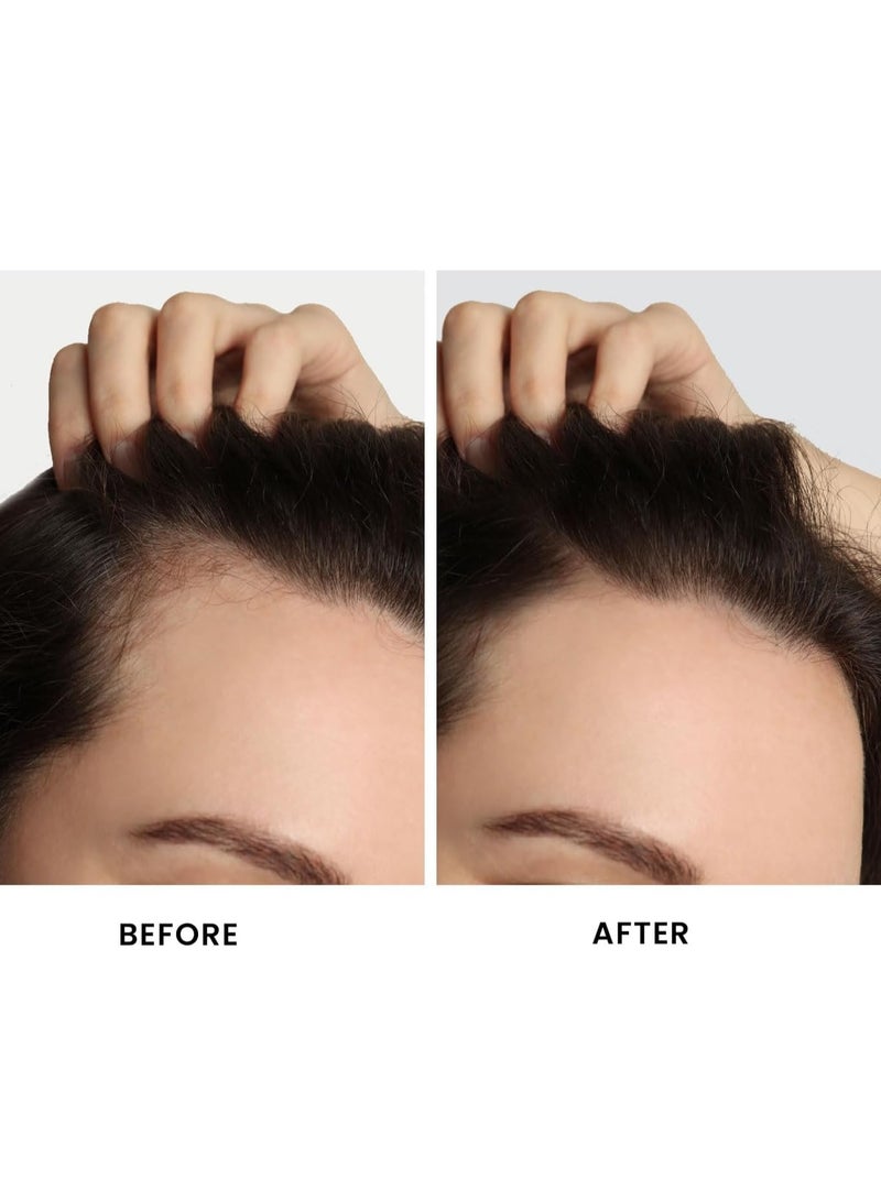 Organic & Botanic 100% Natural Batana Oil for Hair Growth by , Organic, Unrefined Batana Oil for Visibly Thicker and Stronger Hair, Dr Sebi Approved, for all Hair Types （3.4oz/100ml) - Image 5