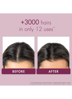 Klorane Strengthening Serum with Quinine and Edelweiss for Thinning Hair, Supports Thicker, Stronger, Healthier Hair, For Men and Women, Paraben, Silicone and Sulfate Free, 3.3 Fl Oz  - Image 4