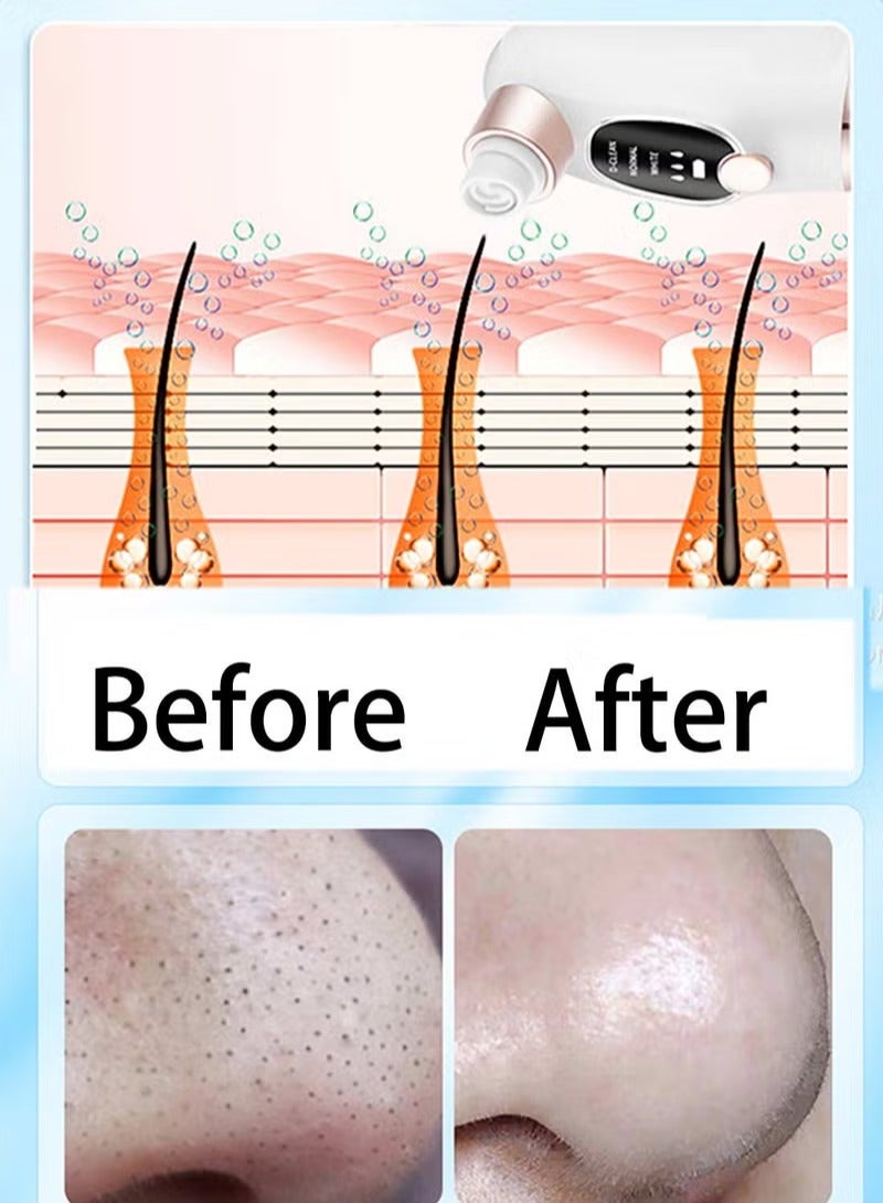 Blackhead Remover, Pore and Facial Vacuum Cleaner, USB Rechargeable Blue Light Cleaning Tools with 3 Modes and 6 Probes - Image 2