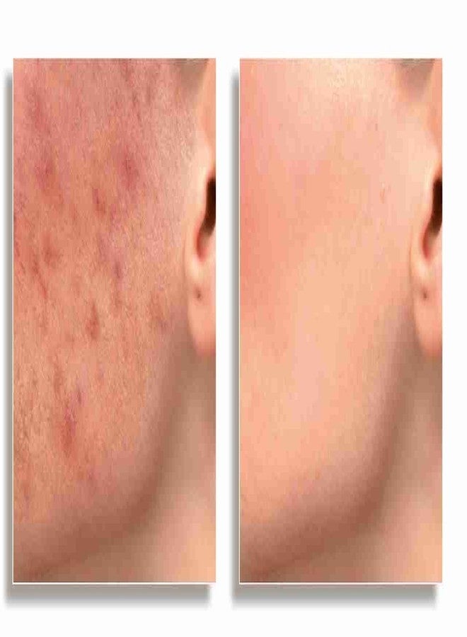 Dermacol Make-Up Cover Colour Light 209 by Dermacol - Image 3