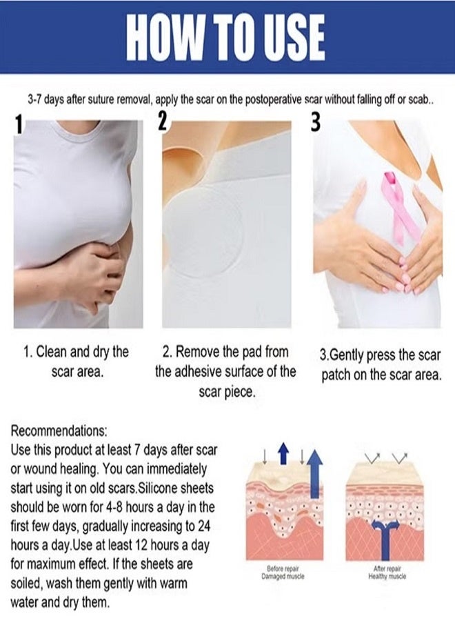 EELHOE 4 Pairs Silicone Scar Sheets, Reusable Washable Silicone Scar Tape, Surgery Scars Removal Treatment, Medical Grade Silicone Scar Sheets for Breast - Image 4