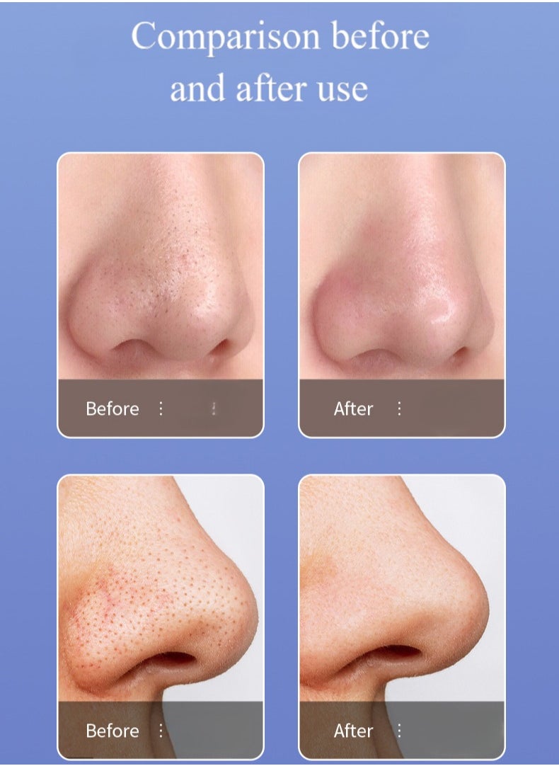 New two-in-one blackhead pore removal blackhead remover, USB rechargeable blackhead vacuum cleaner, blackhead remover facial pore cleaner, electric facial blackhead extraction tool, equipped with 6 suction headbands and 2 water tanks, suitable for three skins (oil/dry/neutral)