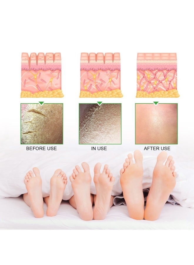 South Moon Cracked Heel Cream 42% Urea with Salicylic Acid – Dermatologist Tested (100g) - Image 4