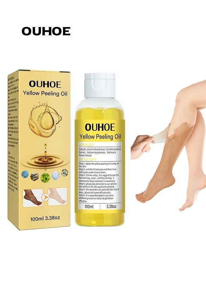 OUHOE 100ml Yellow Peeling Oil Super Strength Exfoliating Dark Skin for Body, Cleansing and Moisturizing - Image 1