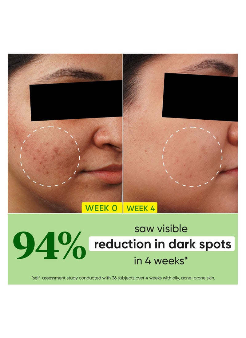 Dot & Key - Dot & Key 10% Niacinamide + Cica Serum | Reduces Acne & Dark Spots | Niacinamide Serum | Controls Excess Oil, Quick Absorbing, & Lightweight | For Oily, Acne Prone & Sensitive Skin | 20ml - Image 1