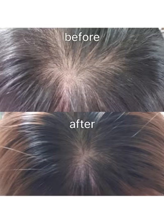 ViveLab Scalp&Hair Serum for Thinning Hair,15ml–Clinically Tested,Nourishing Formula with Biotin,peptide. Promotes Healthy Scalp&Fuller-Looking Hair - Image 4