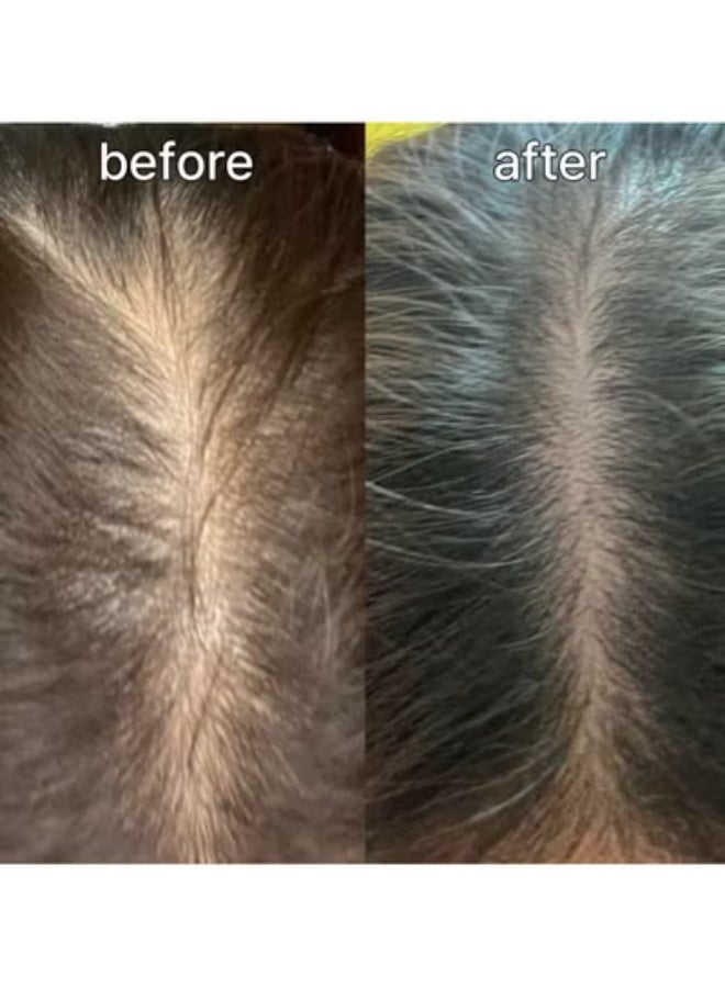 ViveLab Scalp&Hair Serum for Thinning Hair,15ml–Clinically Tested,Nourishing Formula with Biotin,peptide. Promotes Healthy Scalp&Fuller-Looking Hair - Image 5