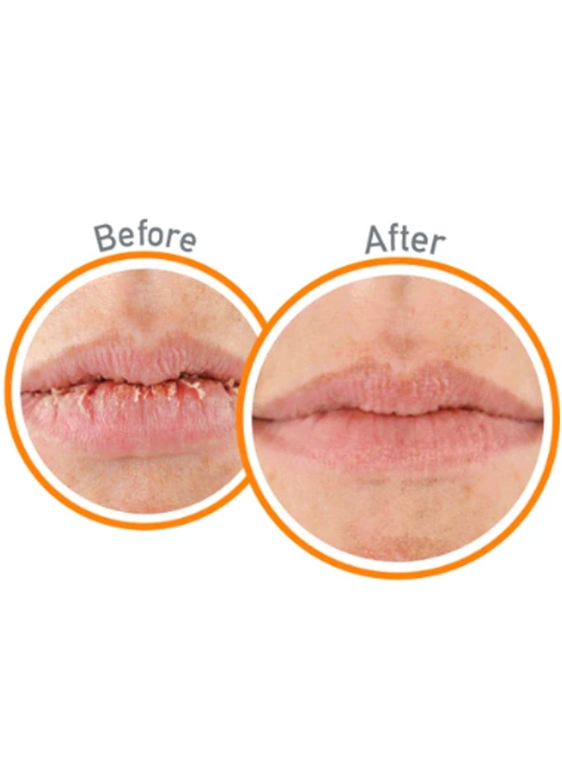O'Keeffe's OKeeffes Lip Repair Lip Balm - 4.2g - Image 4
