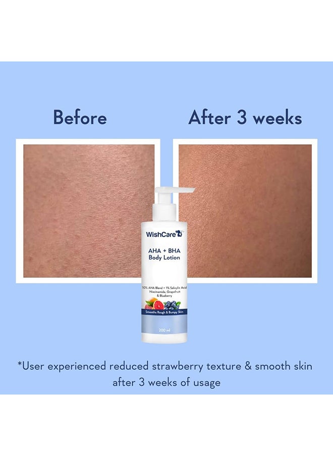 WishCare - 10% AHA + 1% BHA Body Lotion for Men & Women - Body lotion for dry skin - Detans, Smooths Rough & Bumpy Skin 200ml - Image 1