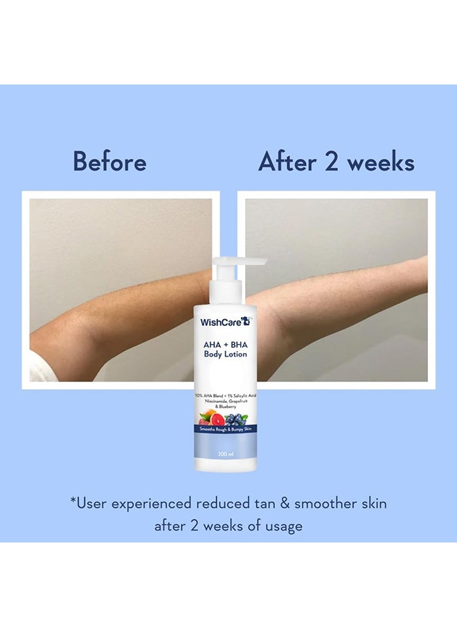 WishCare - 10% AHA + 1% BHA Body Lotion for Men & Women - Body lotion for dry skin - Detans, Smooths Rough & Bumpy Skin 200ml - Image 1