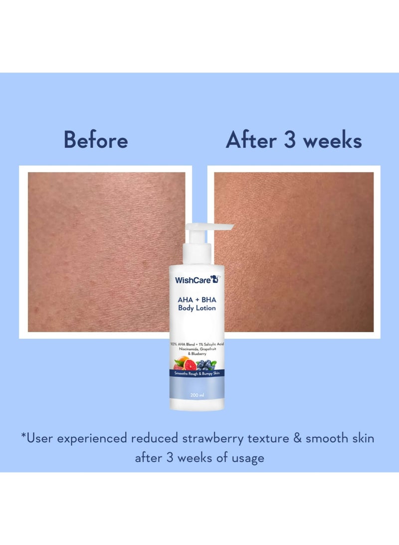 WishCare 10% AHA + 1% BHA لوشن الجسم للرجال والنساء - لوشن للجسم للبشرة الجافة - يزيل التصبغات، ينعم البشرة الخشنة والمطبات 200 مل - Image 4