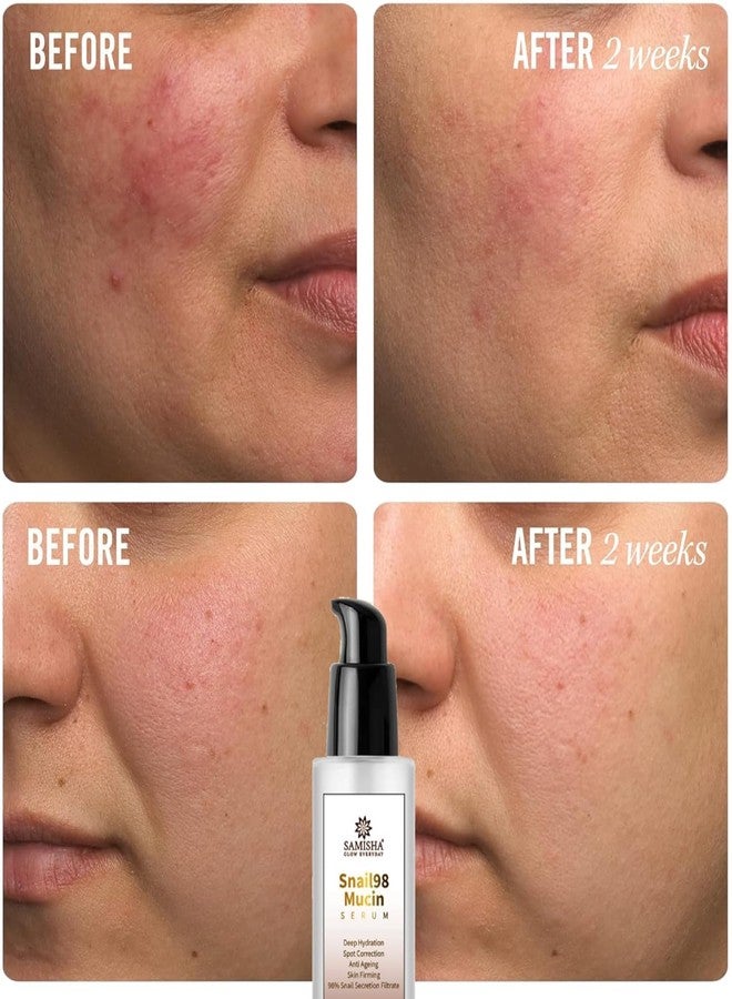 Samisha Snail Mucin Serum Samisha face serum for men and women | anti aging serum for women and men | skin serum for dry skin | best serum for glowing skin | snail serum for combination skin - Image 4