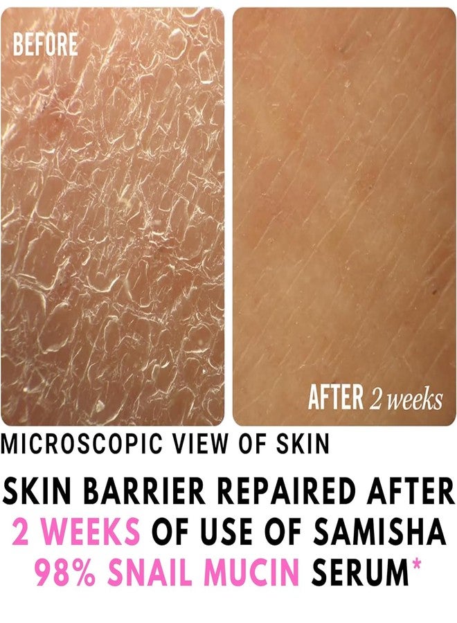 Samisha Snail Mucin Serum Samisha face serum for men and women | anti aging serum for women and men | skin serum for dry skin | best serum for glowing skin | snail serum for combination skin - Image 2