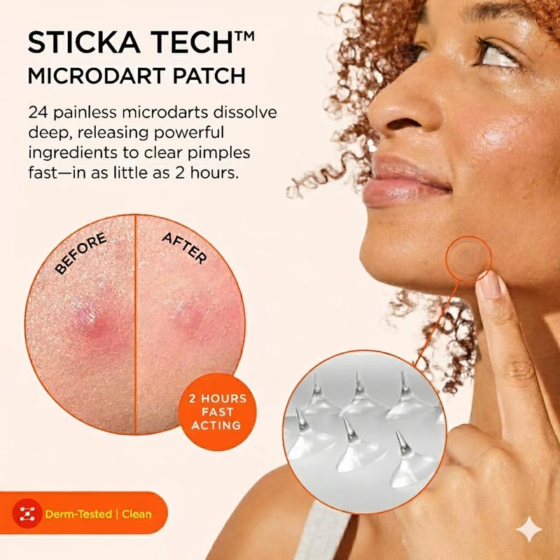 ZitSticka Extra Strength Killa Acne Microdart Patches for Face - OTC Acne Treatment with 2% Salicylic Acid - Fast Acting Microdarts for Deep, Early-Stage Zits & Blemish - 20 Count - Image 2