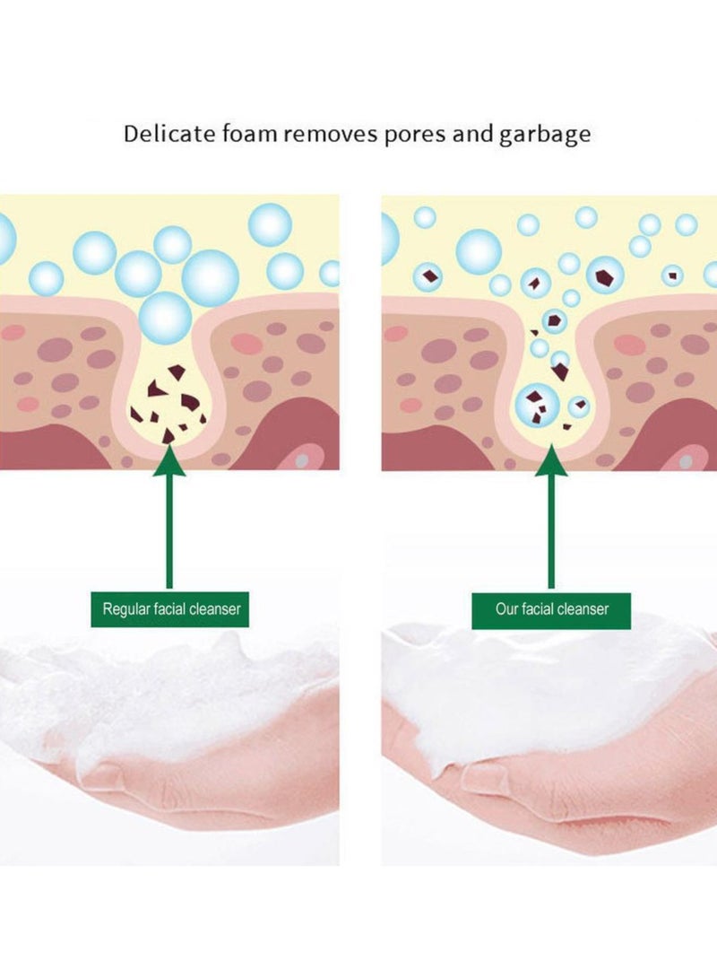 KANGYUAN 120 جرام زيت منظف الوجه المبيض للبقع الرقيقة، رغوة التحكم في البقع، غسول لطيف للبشرة الداكنة - Image 4