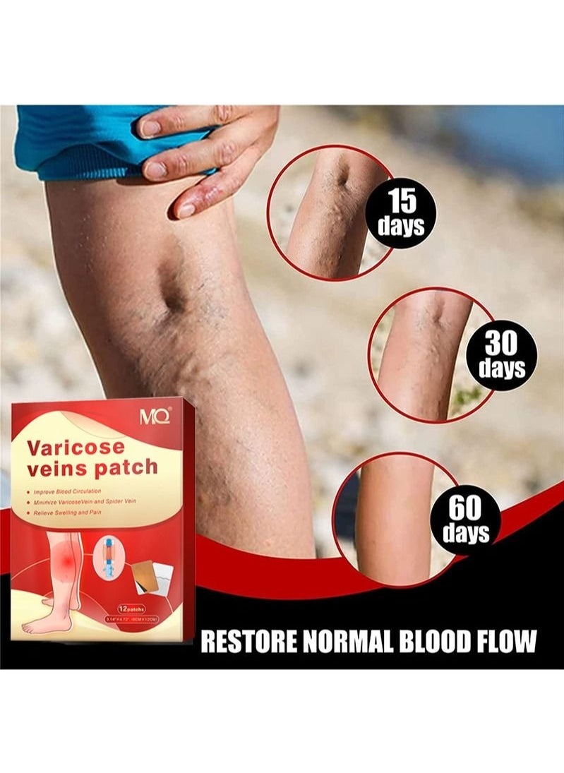 12 pieces of varicose vein treatment patches for legs, promote metabolism, improve blood circulation, and relieve leg fatigue - pzsku/Z6834A042E5715007ECBBZ/45/_/1694190207/bc273dce-0d99-4969-8c6d-e2ac59269859