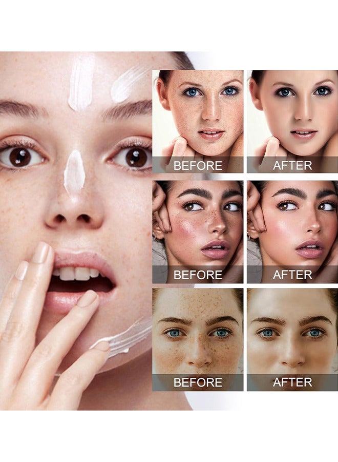 45% Dark Spot Corrector Cream, Dark Spot Remover For Face, Dark Spot Corrector Cream For Age Spot, Blemish Spot, Melasma, Freckle, Sun Spots Remover And Blemish Reducer For Women Or Men, 50ML
