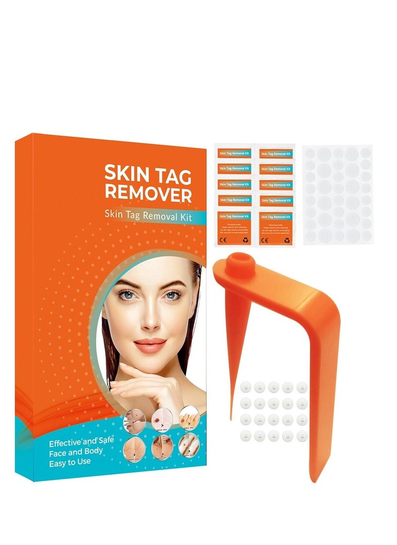 Kanza Micro Skin Tag Removal Kit - Painless Skin Tag Remover for Most Body Parts - Safe for Small (2mm) to Medium (5mm) Skin Tags  - Image 1