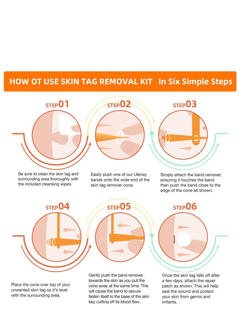 Kanza Micro Skin Tag Removal Kit - Painless Skin Tag Remover for Most Body Parts - Safe for Small (2mm) to Medium (5mm) Skin Tags  - Image 3