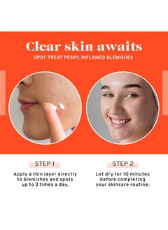 NO B. S. NO BAD STUFF No Bad Stuff - Acne Spot Treatment - Acne Control with 2% Salicylic Acid, Fades Blemishes, with Chamomile, Aloe Vera & Vitamin E (0.5 oz)  - Image 5
