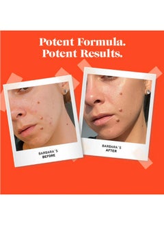 NO B. S. NO BAD STUFF No Bad Stuff - Acne Spot Treatment - Acne Control with 2% Salicylic Acid, Fades Blemishes, with Chamomile, Aloe Vera & Vitamin E (0.5 oz)  - Image 2