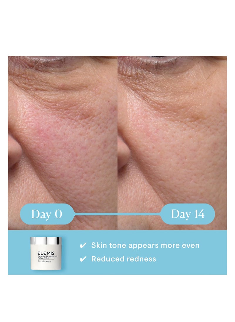 Elemis - ELEMIS Dynamic Resurfacing Facial Pads | Gentle Dual-Action Textured Treatment Pads Conveniently Smooth, Resurface, and Exfoliate Skin - Image 1