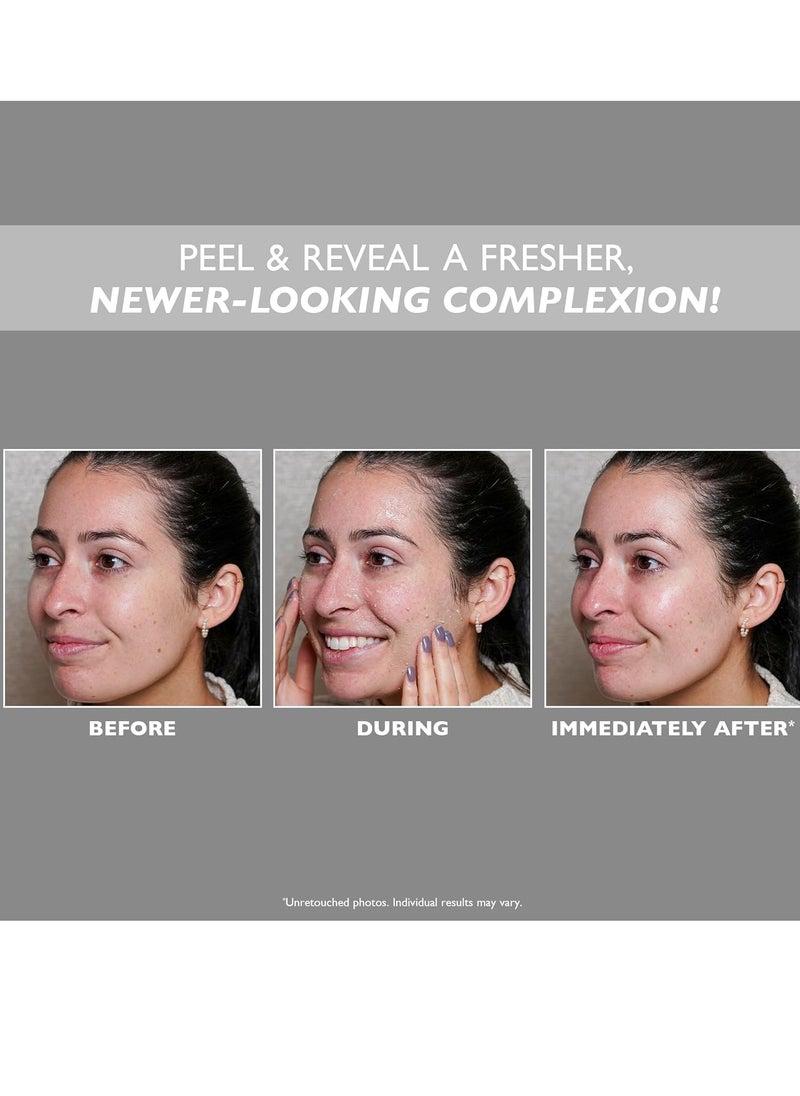PETER THOMAS ROTH Peter Thomas Roth Firm X Peeling Gel  - Image 2
