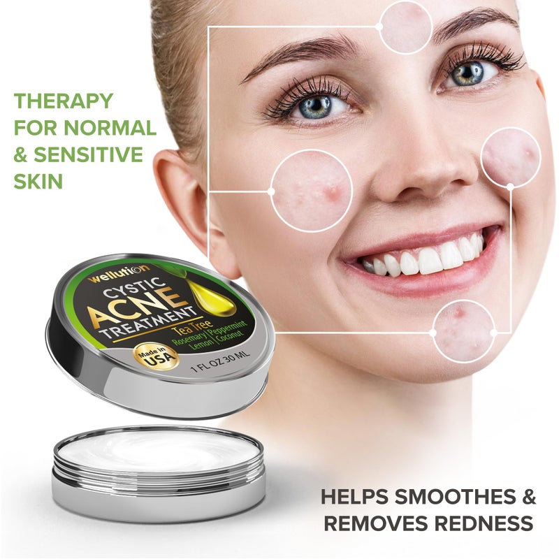 WELLUTION Cystic Acne Spot Treatment â€“ Tea Tree Acne Cream â€“ Fast-Acting Acne Spot Corrector for Face, Pimples & Blemishes â€“ Non-Greasy, Gentle Formula â€“ 1oz â€“ by WELLUTION - Image 3