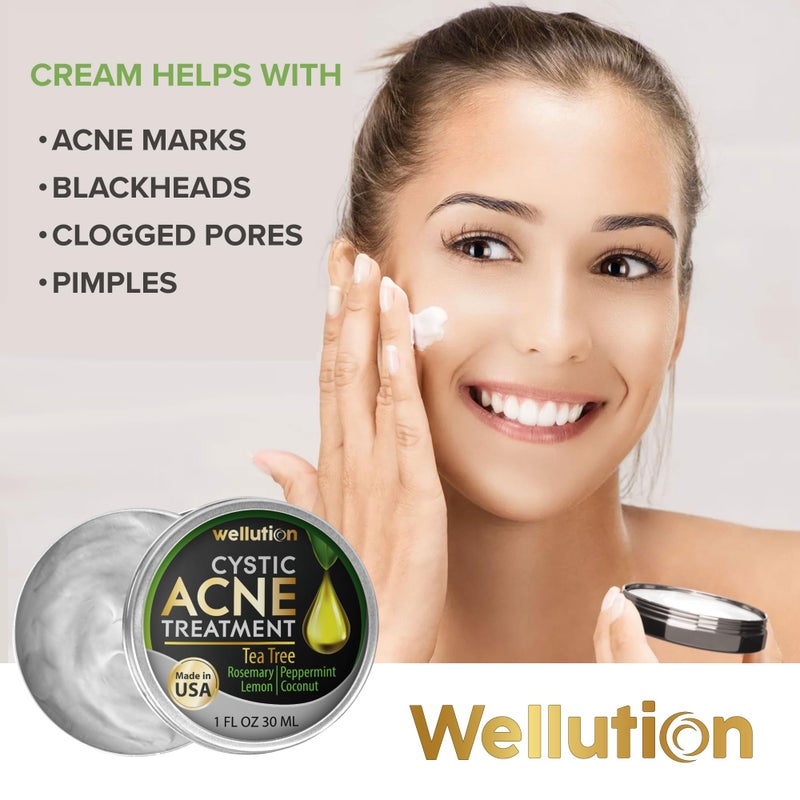 WELLUTION Cystic Acne Spot Treatment â€“ Tea Tree Acne Cream â€“ Fast-Acting Acne Spot Corrector for Face, Pimples & Blemishes â€“ Non-Greasy, Gentle Formula â€“ 1oz â€“ by WELLUTION - Image 2