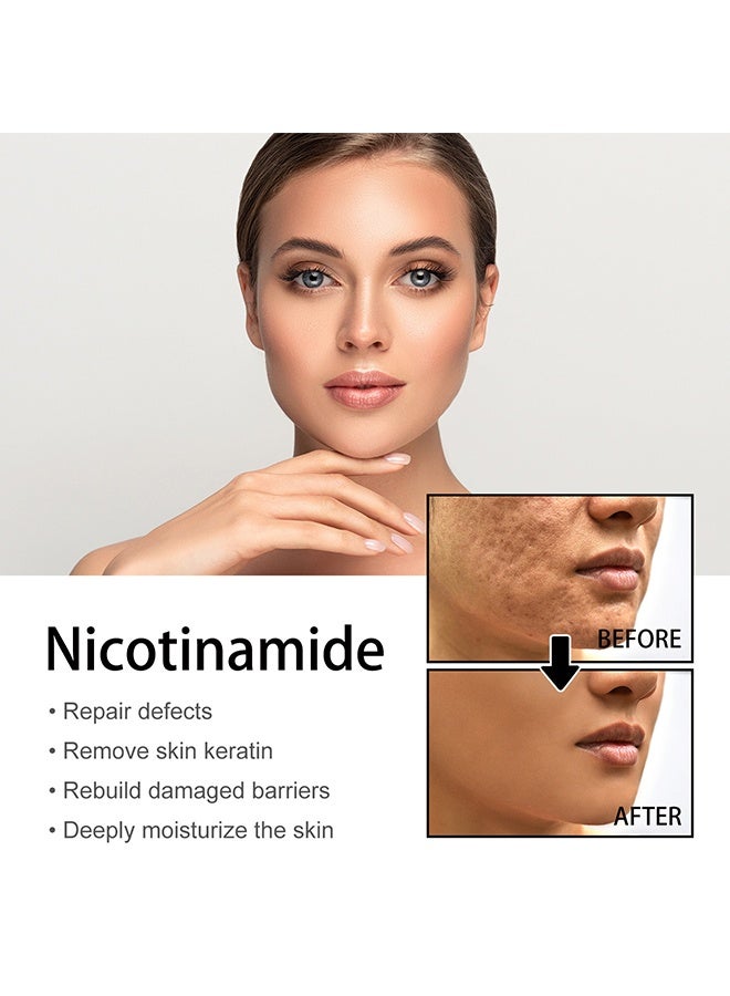 EELHOE Facial Whitening Calming And Soothing，Niacinamide Freckles Removal Serum, Sunnylas Niacinamide Freckles Removal Serum, Niacinamide Serum for Face and Body, Nicotinamide Serum for Blemishes, for All Type Skin 50ml - Image 2