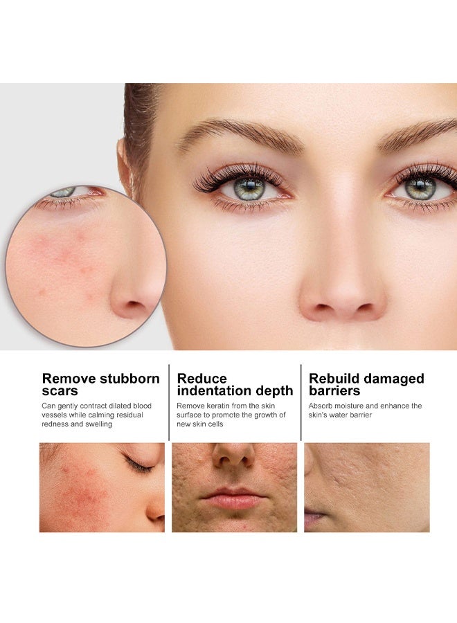 EELHOE Facial Whitening Calming And Soothing，Niacinamide Freckles Removal Serum, Sunnylas Niacinamide Freckles Removal Serum, Niacinamide Serum for Face and Body, Nicotinamide Serum for Blemishes, for All Type Skin 50ml - Image 3