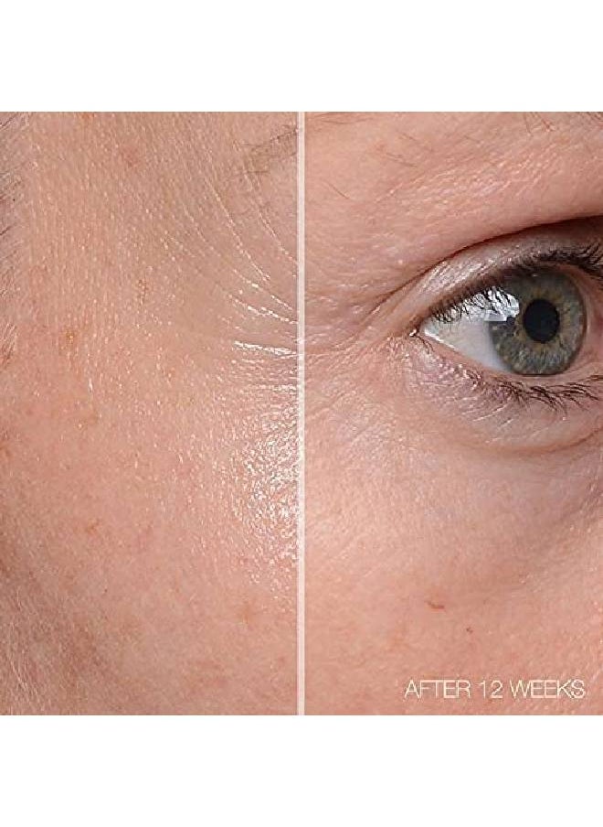 MD Complete by Dr. Brian Zelickson - Md Complete Total Eye Treatment ; Antiaging Hydrating Skin Renewal Eye Treatment ; With Peptides, Vitamins C & E And Hyaluronic Acid For Wrinkles, Fine Lines And Crows Feet 0.5 Fl Oz - Image 1