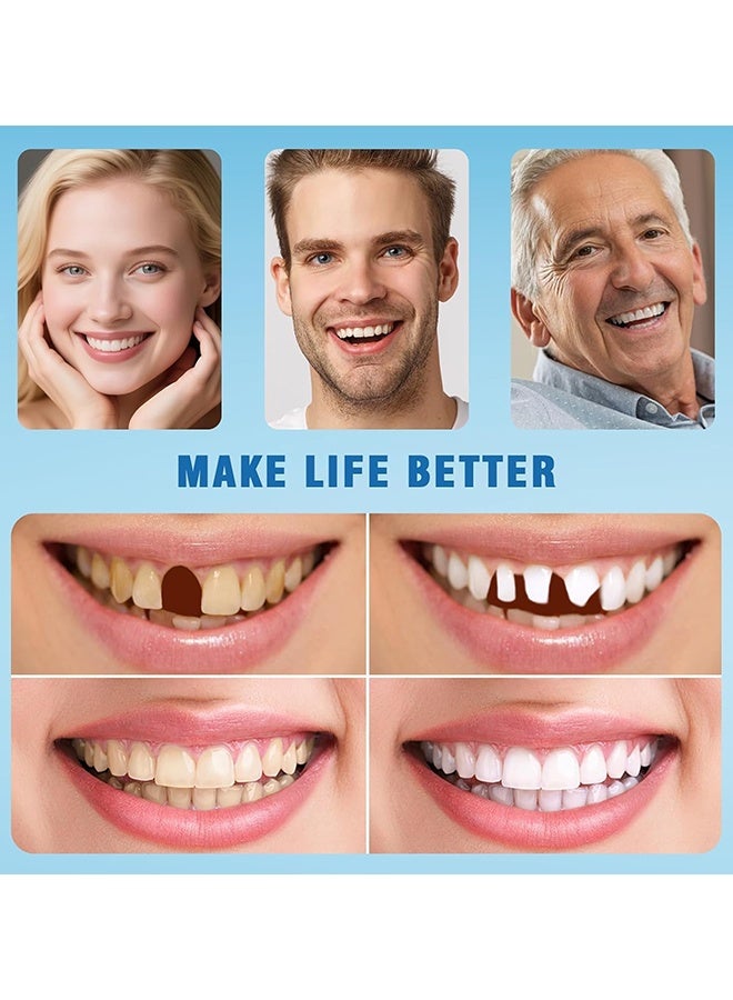 ORALHOE Silicone Reline Denture Set, Denture Silicone Reline Kit For Dentures, Soft Denture Reline Kit For Men And Women, Complete Teeth Veneer Kit, Unisex Denture Reline Kit Is Suitable For Securing Upper And Lower Dentures - Image 2