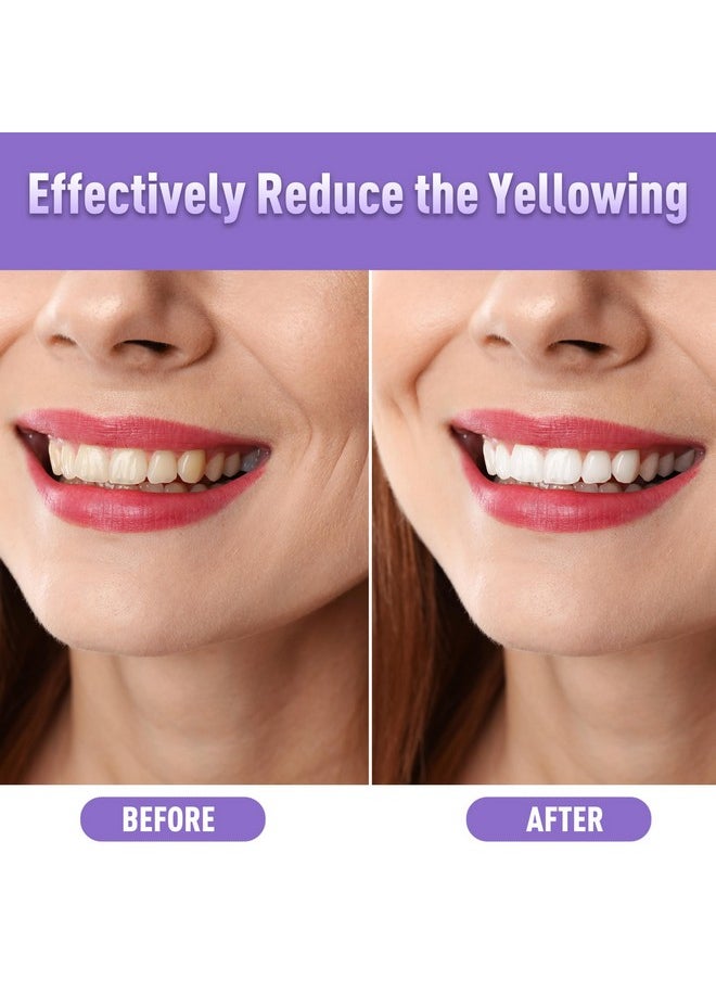 UBESTSMILE Teeth Whitening Pen (4 Pcs) Whiten Teeth 40+ Uses Remove Stains Effective Painless Insensitive Fresh Fragrance Travelfriendly Datingfriendly Mint Flavor  - Image 2
