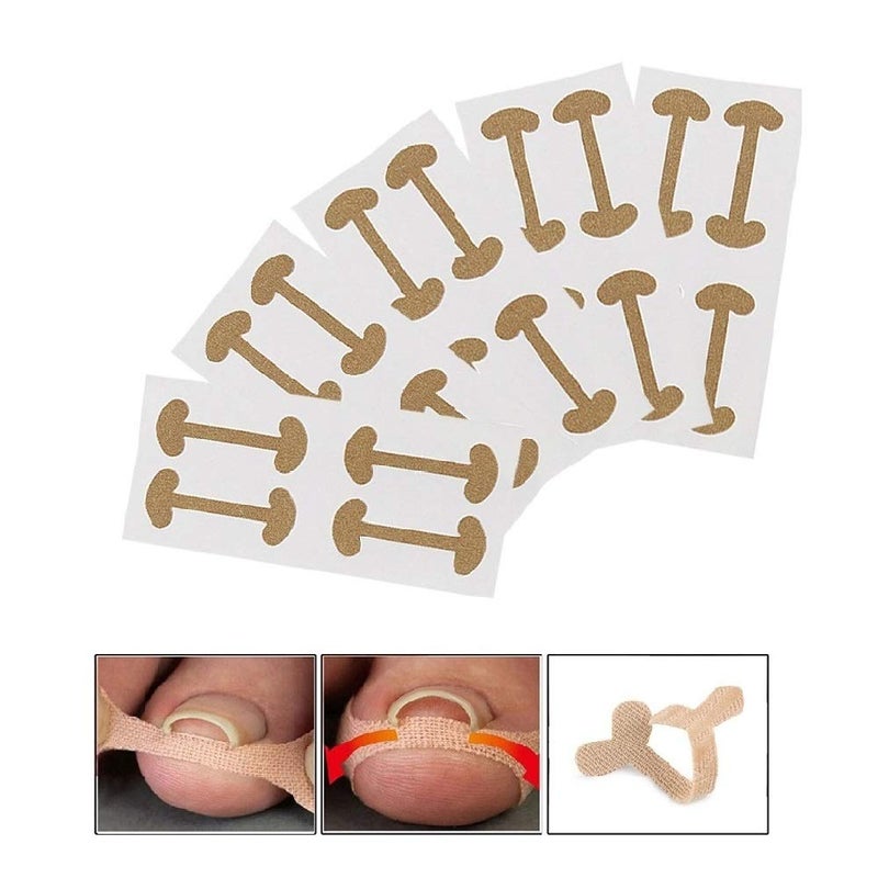 EBANKU Ingrown Toenail Treatment Strips 20 Pcs Toe Nail Correction Patch Elastic Patch Sticker Corrector Pedicure Tools Fingernail Toe Nail Care