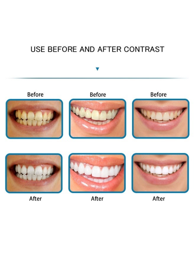 جهاز تنظيف الأسنان بالماء اللاسلكي - جهاز تنظيف فموي محمول قابل لإعادة الشحن مزود بأربع رؤوس نفث، وثلاثة أوضاع ضغط، وتصميم مقاوم للماء للعناية بالأسنان أثناء السفر والمنزل - Image 5