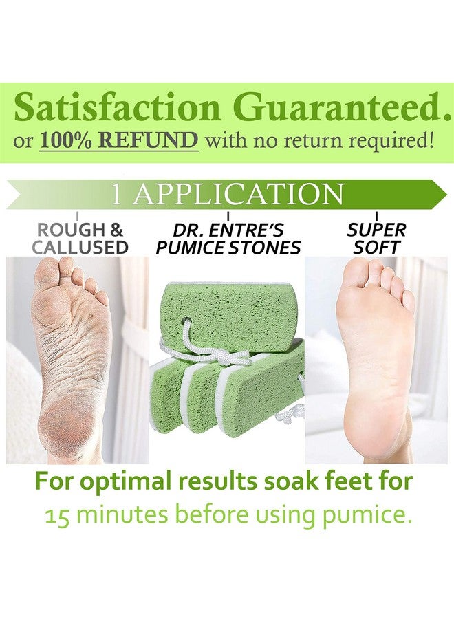 EntreFeet Dr. Entre'S Pumice Stone For Feet 4 Pack Callus Remover Dead Skin Scraper Exfoliator For Scrubber Use Pedicure Tools Cracked Heels Foot Care - Image 5