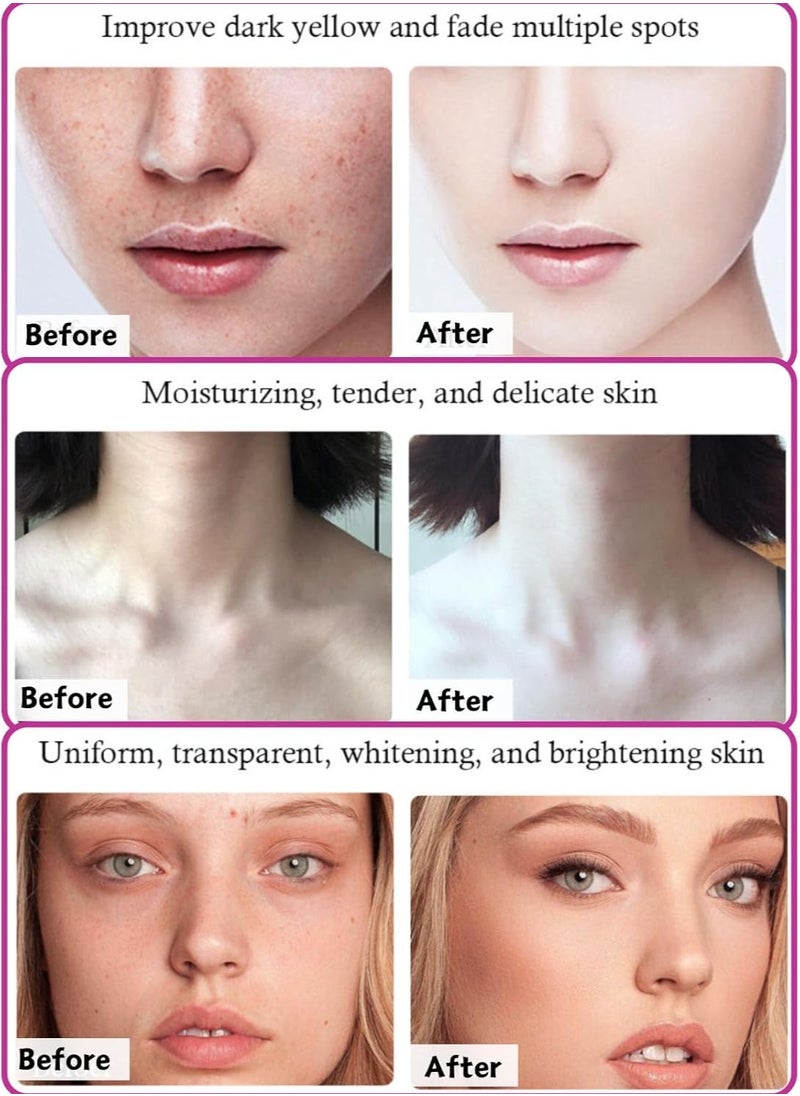 KOJIC ACID - Kojic Acid Face Cream, Kojic Acid Cream for Dark Spots, Collagen Cream, Dark Spot Treatment Cream for Women, Anti-Aging & Even Skin Tone, Dark Spot Remover for Face, Body, Hands, Armpits 80ml - Image 1