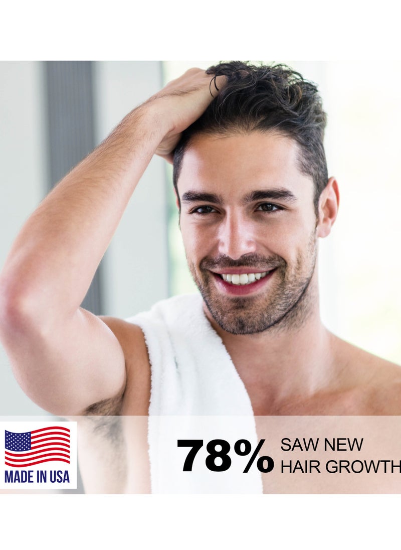 SOTI - Soti Minoxidil 5% Hair Growth, Hair Loss Regrowth Serum 60ml. Made in USA! Dermatologists Recommended. Ginseng and Biotin Extra Strength Formula (1 Pack) - Image 1