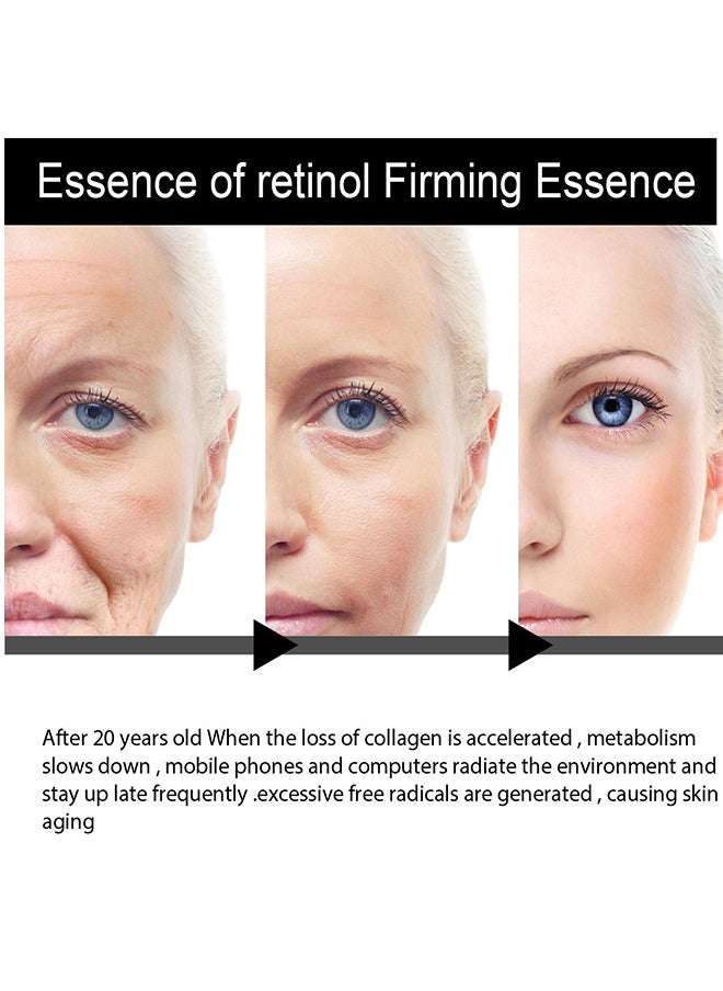 OUHOE Retinol Serum Anti-Aging & firming , Vitamine E & Antioxidants Hyaluronic Acid Anti-Aging Serum, Reduces Wrinkles, Fine Lines, Age Spots, Sun Spots, Anti Wrinkle Facial Serum 30ml  - Image 4