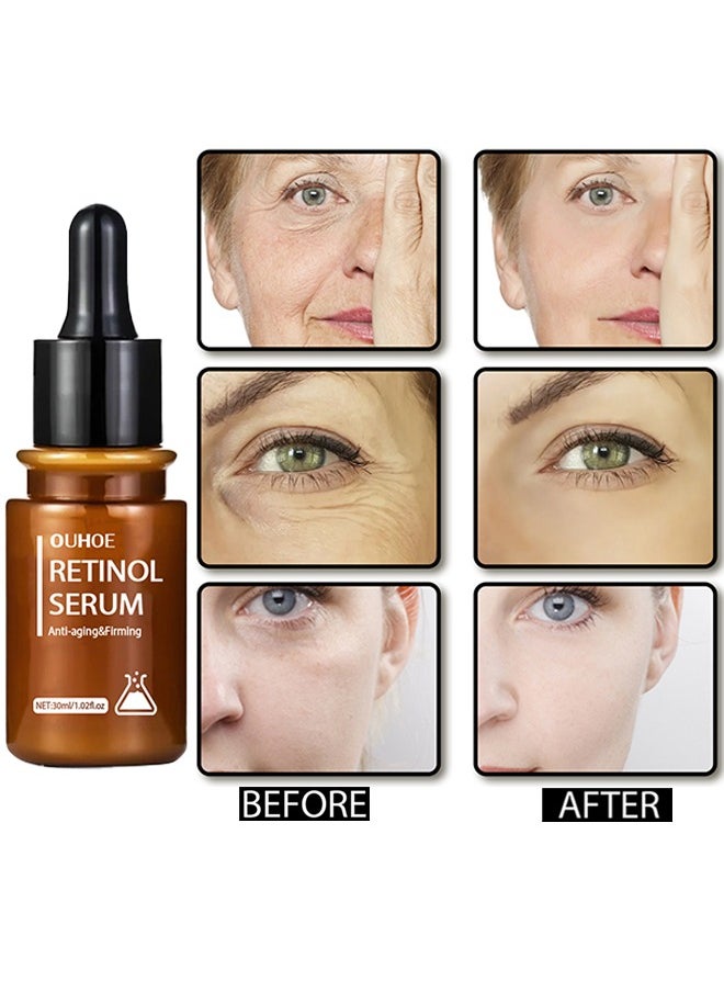OUHOE Retinol Serum Anti-Aging & firming , Vitamine E & Antioxidants Hyaluronic Acid Anti-Aging Serum, Reduces Wrinkles, Fine Lines, Age Spots, Sun Spots, Anti Wrinkle Facial Serum 30ml  - Image 3