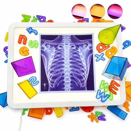 RANGRANGMANJIA LED Light Up Table for Kids, Shine Bright Light Box with 10 Levels & 3 Color Modes, Portable Dimmable Box for Tracing, Magna-Tiles, Art & Education, Fits IKEA Flisat Table, Home & Classroom(16" Blue) - Image 1