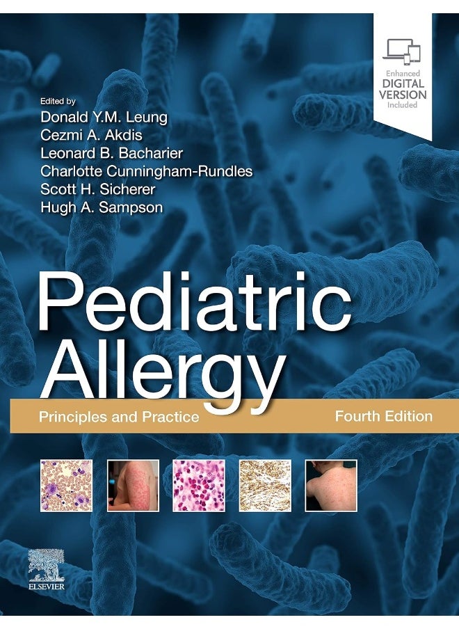Pediatric Allergy: Principles and Practice: Principles and Practice 