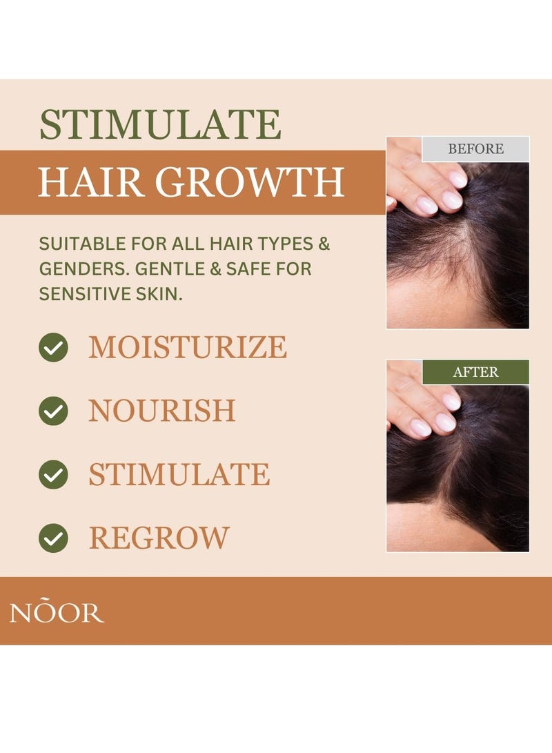 Noor رذاذ ونتر جروث للنساء، 9 في 1 سوبر بوست، علاج طبيعي لتساقط الشعر مع مستخلص حبوب القهوة وكيراتين ساينتين لجعل الشعر أكثر كثافة وصحة، يعزز بشكل ملحوظ كثافة الشعر في 8-12 أسبوعًا - Image 4